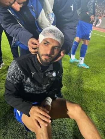 هواداران پرسپولیس سر بازیکن استقلال را شکستند!