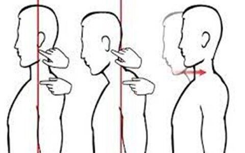 چند حرکت اصلاحی برای درمان قوز گردن