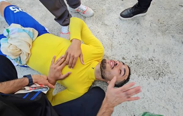 حمله خونین به آبادانی‌ها در نوشهر/عکس