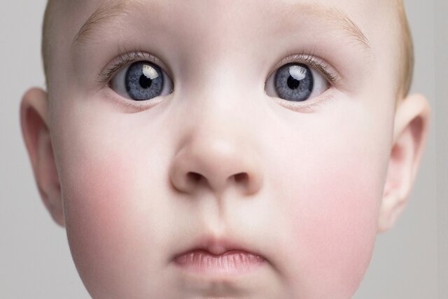 ریشه های زوال عقل در کودکی سبز می شود!